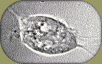 Trichomonas